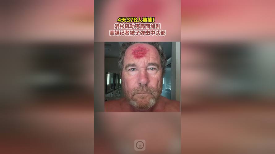 新澳2025正版免費資料和洛杉矶部分地区宵禁与洛杉矶部分地区宵禁严重吗